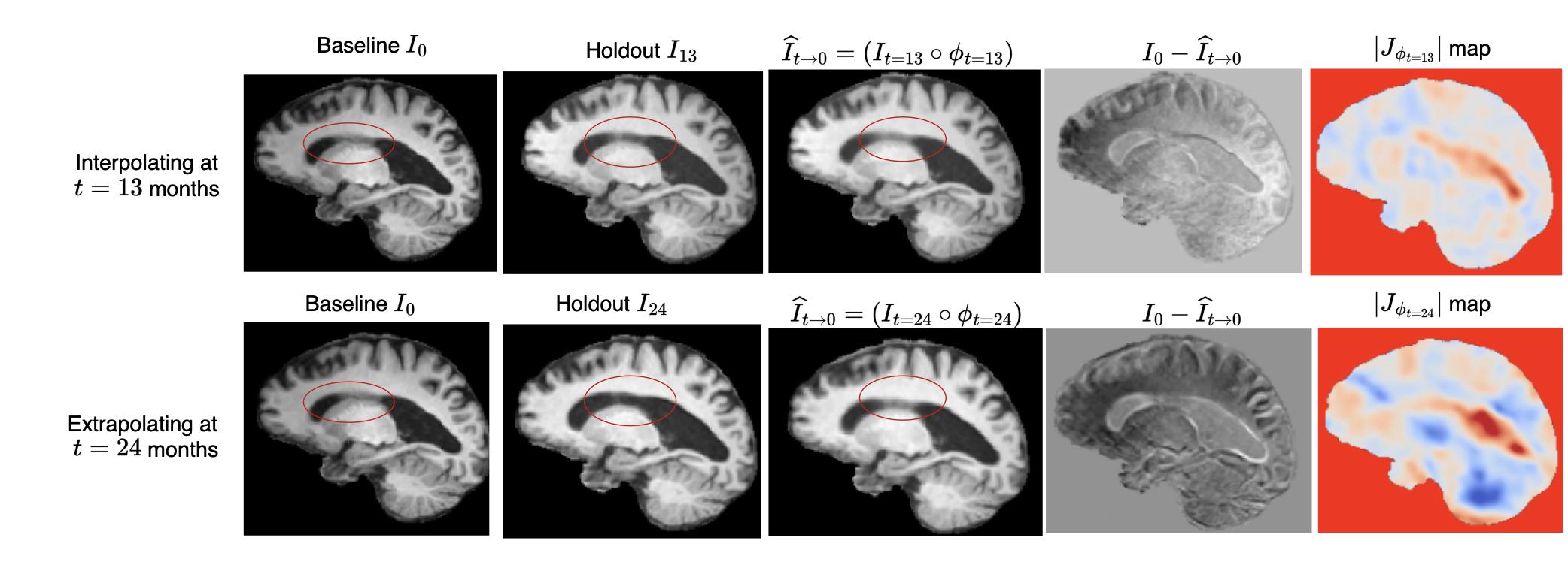 Medical Image Analysis
