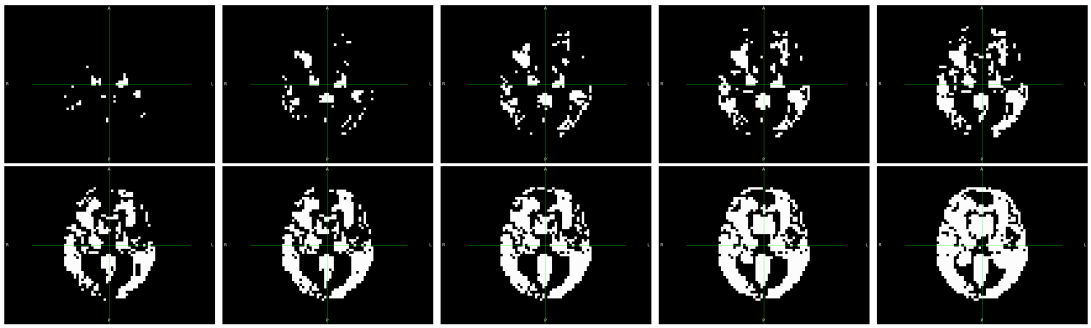 Progression Modelling